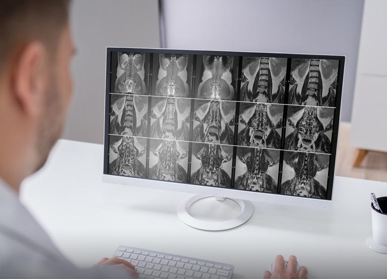 zdjęcia na monitorze z rezonansu